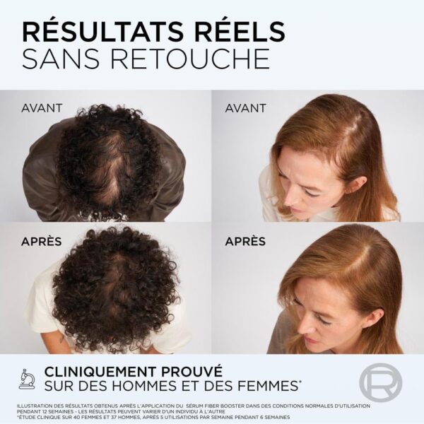 L’OREAL PARIS – Elseve Fiber Booster – Protocole Anti-Chute Cheveux - Stimule la Pousse* – Augmente la Densité Capillaire – Hommes & Femmes - Shampooing Sans Sulfates + Démêlant Sans Silicones + Sérum – Image 2